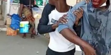 Police brutality leaves scores injured and others detained