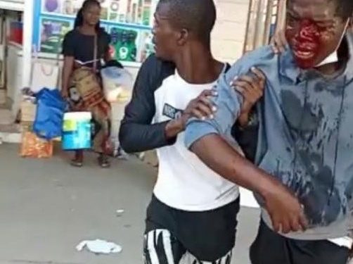 Police brutality leaves scores injured and others detained